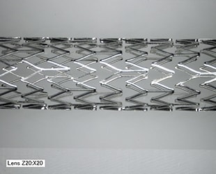 扩张导管支架的全方位拍摄（20×）